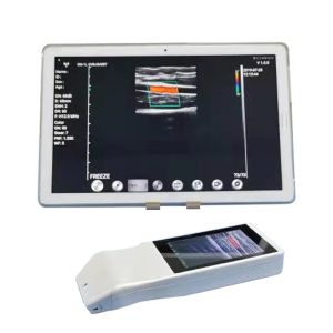 Dispositivo scanner a ultrasuoni doppler a colori wireless portatile MY-A024-Z
