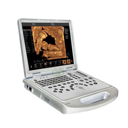 Laptop portatile color doppler ultrasound MY-A024B-N