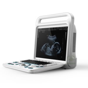 Scanner ultrasound color doppler portatile MY-A027-B